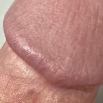 LkMcTuRniP