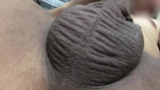 scrotum testicles/ejaculation and convulses