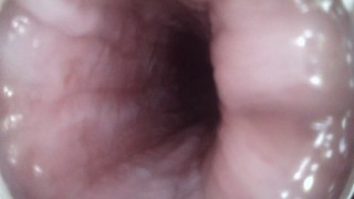 Endoscope through urethra to prostate while masterbating
