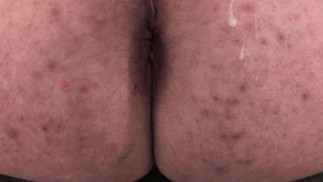 Cumming On My Own Ass Watch My Butthole Pulse